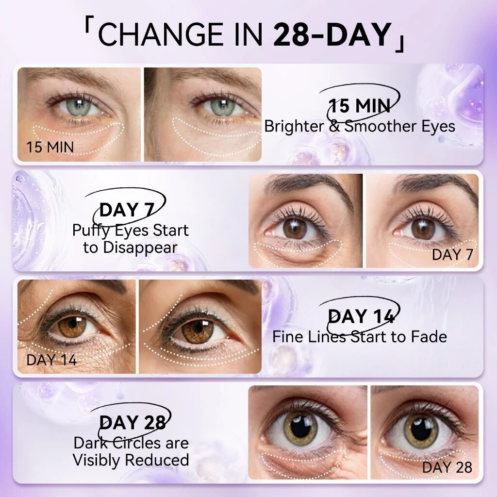 LANBENA Retinol Anti-Rimpel Oo - Microneedle Patch Eye recensie en prijs