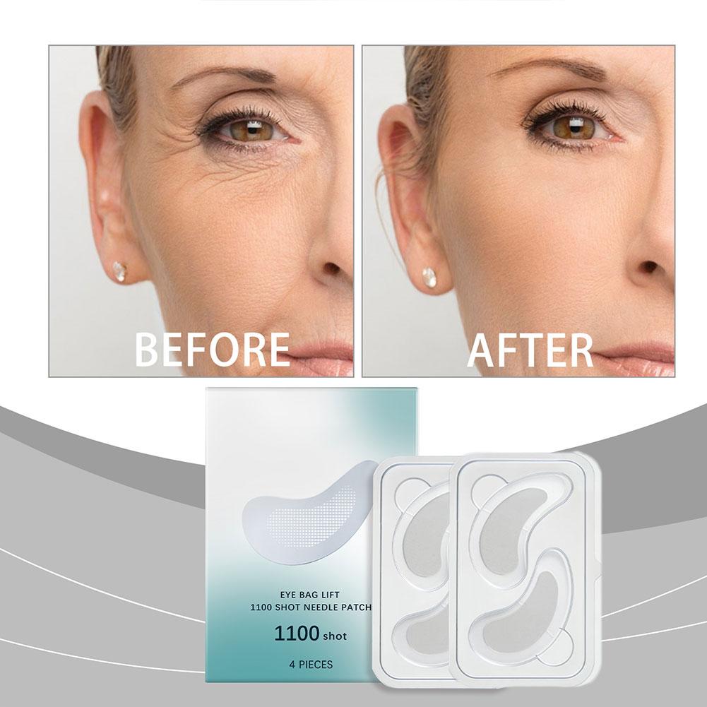 Hyaluronzuur Microneedle Eye P - Microneedle Patch Eye recensie en prijs