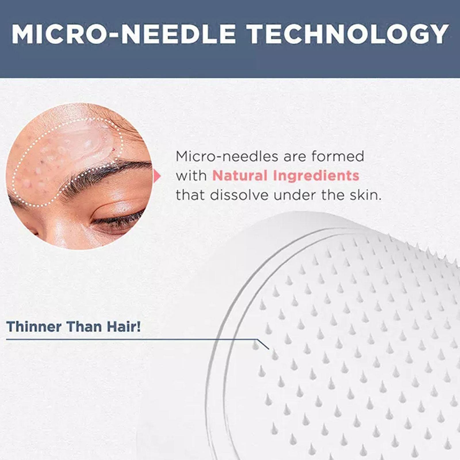 0,2 mm micro-naald oogmasker m - Microneedle Patch Eye recensie en prijs